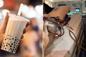 Bác sĩ cảnh báo món khoái khẩu của giới trẻ là nguyên nhân gây hỏng thận không thể phục hồi