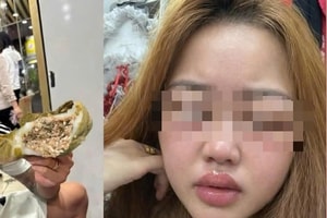 Bánh trứng kiến là đặc sản ở đâu? Ai dễ bị dị ứng khi ăn bánh trứng kiến?