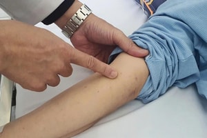 Sốt xuất huyết, COVID-19, não mô cầu đồng loạt gia tăng: Bộ Y tế cảnh báo ‘nóng’