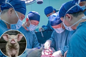 Trung Quốc lập kỳ tích y học thế giới với ca ghép cùng lúc gan và 2 quả thận lợn vào cơ thể người
