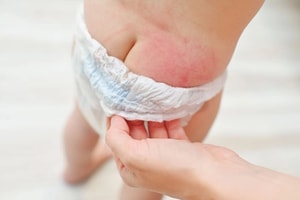 Rúng động: Phát hiện chất độc ảnh hưởng sinh sản trong hãng tã bỉm trẻ em Huggies, có thể ngấm vào máu và nước tiểu