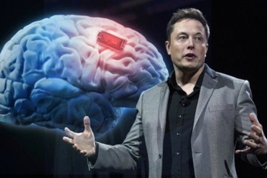 Tỷ phú Elon Musk nghiên cứu dự án gắn chip vào não bộ con người