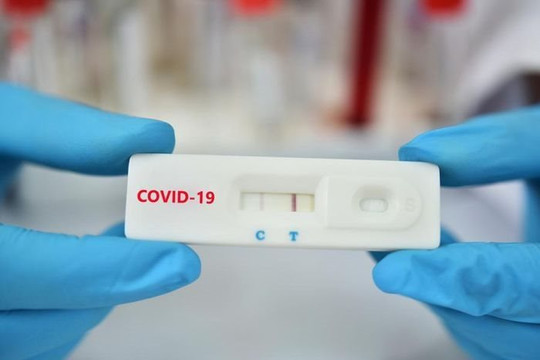 Cập nhật bảng giá chi tiết dịch vụ xét nghiệm COVID-19 mới nhất