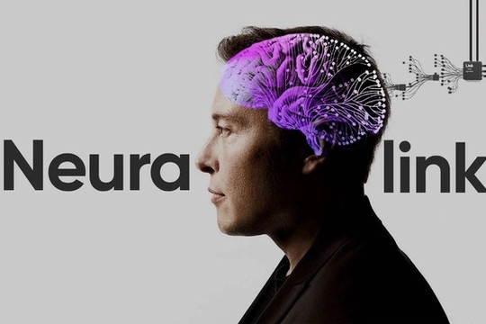 Startup cấy ghép não của Elon Musk được chấp thuận thử nghiệm trên cơ thể người