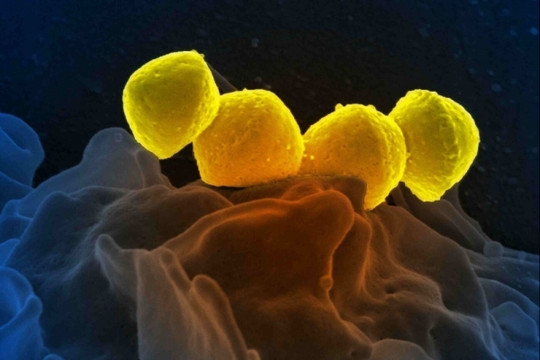 Vi khuẩn 'ăn thịt người' gây tử vong trong 48 giờ lây lan tại Nhật Bản