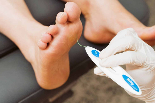 4 triệu chứng ở chân cảnh báo bệnh tiểu đường đã nghiêm trọng