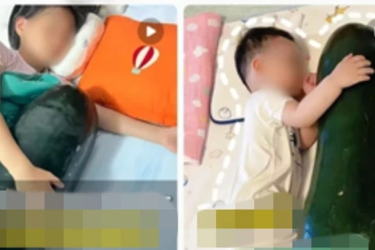 Nóng đỉnh điểm, Trung Quốc nở rộ trào lưu ôm bí đao đi ngủ cho mát