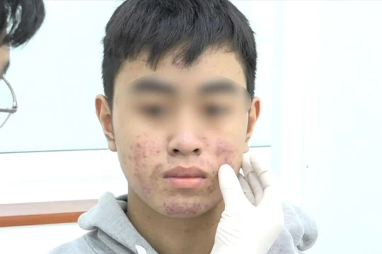 'Hàng hiệu' giá bèo từ chợ đến mạng - bài 2: Phía sau lời quảng cáo 'trắng cấp tốc'