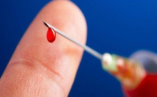 Virus ‘sát thủ’ lây nhanh gấp 100 lần HIV, Việt Nam thuộc nhóm có tỷ lệ nhiễm cao nhất khu vực