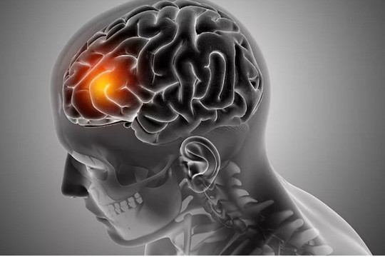 Phát triển thuốc điều trị ung thư dạng nhỏ mũi