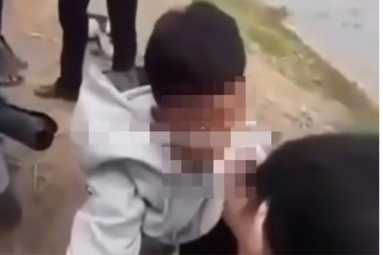 Sở Giáo dục chỉ đạo làm rõ vụ nam sinh lớp 10 bị nhét băng vệ sinh vào miệng