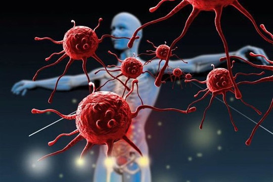 Việt Nam có hơn 180.000 ca ung thư mới mỗi năm, ung thư tuyến giáp chiếm tỷ lệ cao nhất