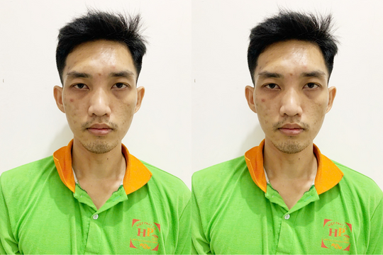 Nguyễn Quốc Thịnh, 30 tuổi bị truy nã vì trộm 17kg khô mực ra đầu thú