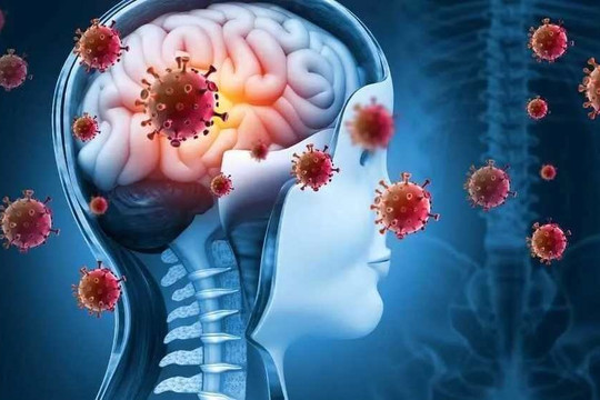 Bác sĩ Trương Hữu Khanh nói về căn bệnh phổ biến ở trẻ em châu Á, tỷ lệ tử vong lên đến 30%