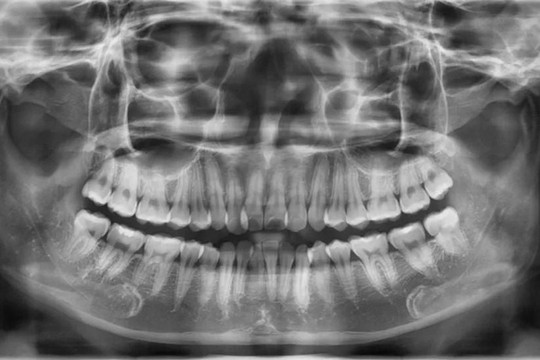 34 sinh viên khoa Răng Hàm Mặt dùng Photoshop để chỉnh sửa phim X-quang