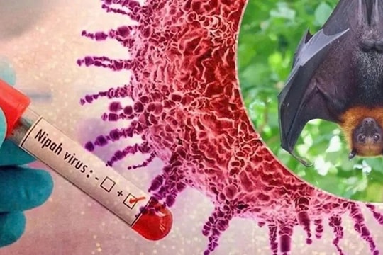 5 lý do khiến WHO xếp Nipah vào nhóm mầm bệnh nguy hiểm nhất thế giới