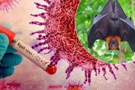 Bộ Y tế công bố phác đồ chẩn đoán và điều trị virus Nipah