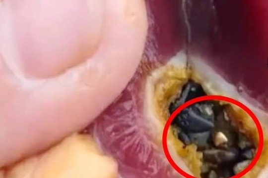 Người đàn ông phát hiện gần 3 chỉ vàng, trị giá gần 50 triệu bên trong dạ dày vịt